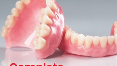 Dental Implants vs Dentures