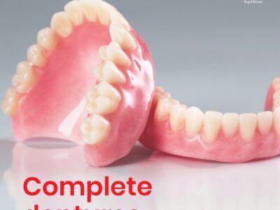 Dental Implants vs Dentures