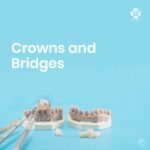 crowns and bridges