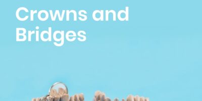 crowns and bridges