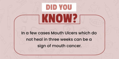 Oral Cancer Ulcer