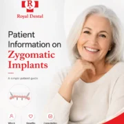 Patient information on Zygomatic Dental Implants Royal Dental Clinics Patient Information on Zygomatic Implants