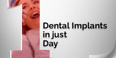 Dental Implants in one day