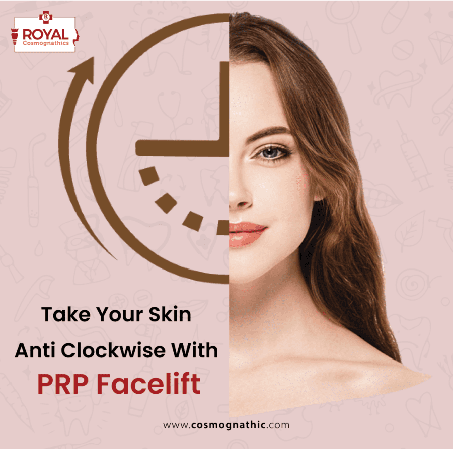 cheekbone or facelift