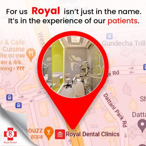 royal dental Kandivali best dentist in mumbai
