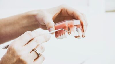Single stage Dental implant