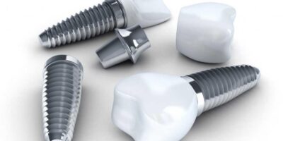 dental implant types