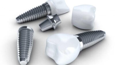 dental implant types