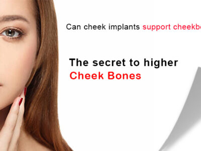 cheekbone implants