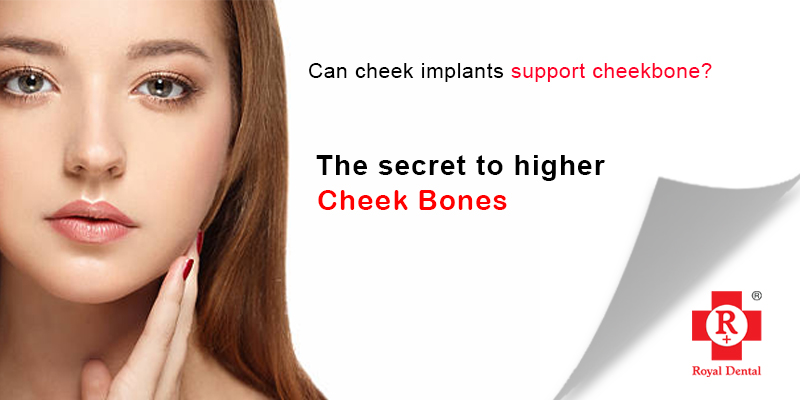 cheekbone implants