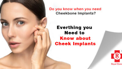 Cheekbone Implants