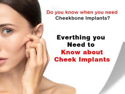 Cheekbone Implants