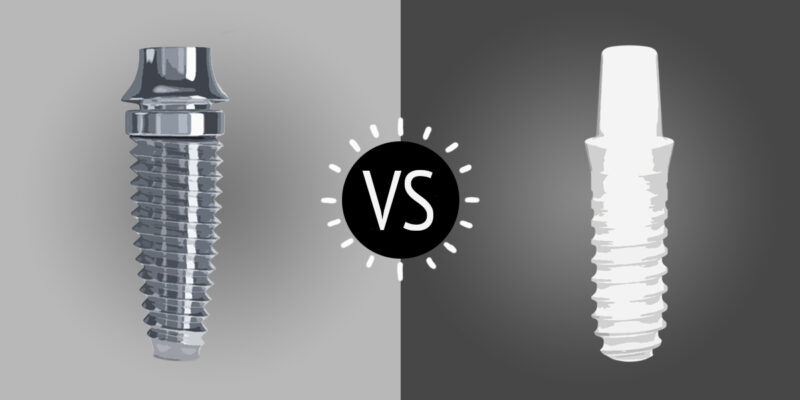 zirconia vs titanium dental implant