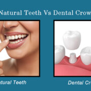 Natural teeth vs dental crown