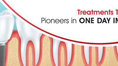 One-Day Dental Implants: Same-Day Fixed Teeth Royal Dental Clinics full mouth dental implants