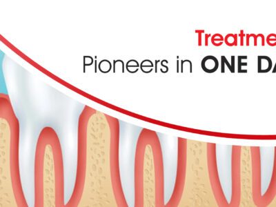 full mouth dental implants