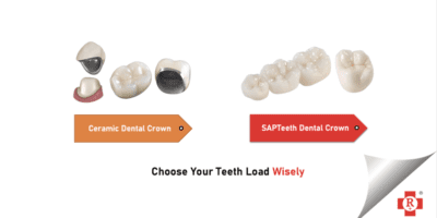 SAPTeeth vs Ceramic Crown