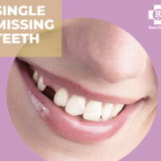 Single Missing Teeth