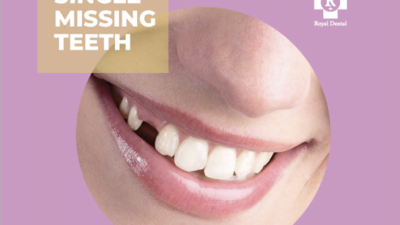 Single Missing Teeth