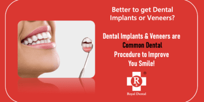 crowns or veneers or implants