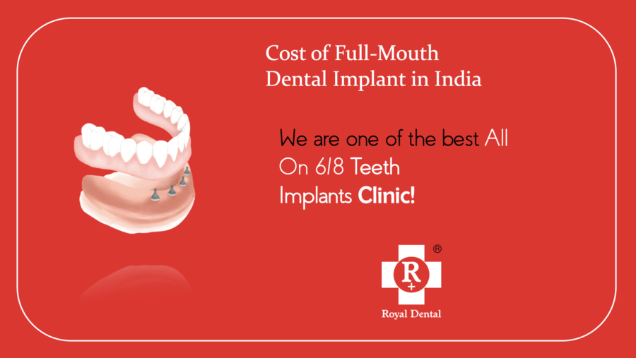 cost-of-dental-implant-in-india