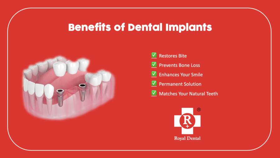 dental-implants-AIIMS