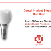 dental implant in one day
