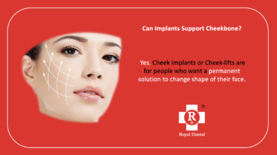 cheek bone implants