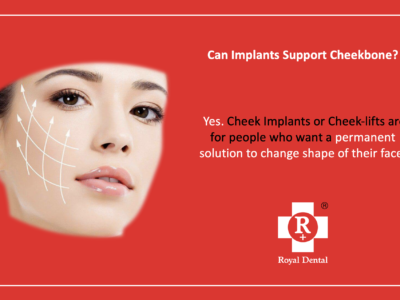 cheek bone implants