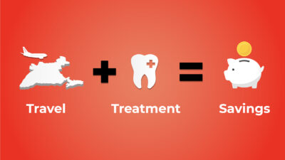 Cost of Tooth Implants India