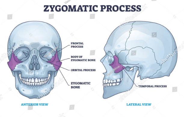 Do you need a surgery for reshaping Cheekbones? Royal Dental Clinics surgery for reshaping Cheekbones