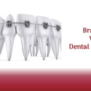 braces vs dental implants