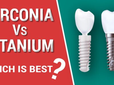 titanium vs zirconia dental implants