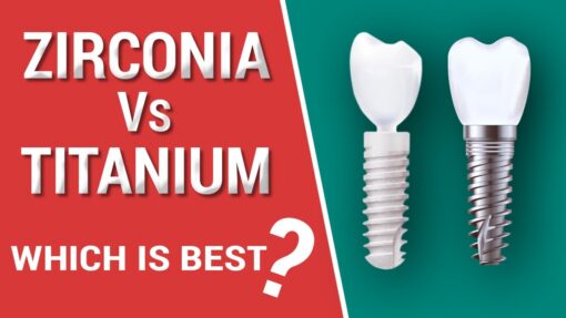 titanium vs zirconia dental implants