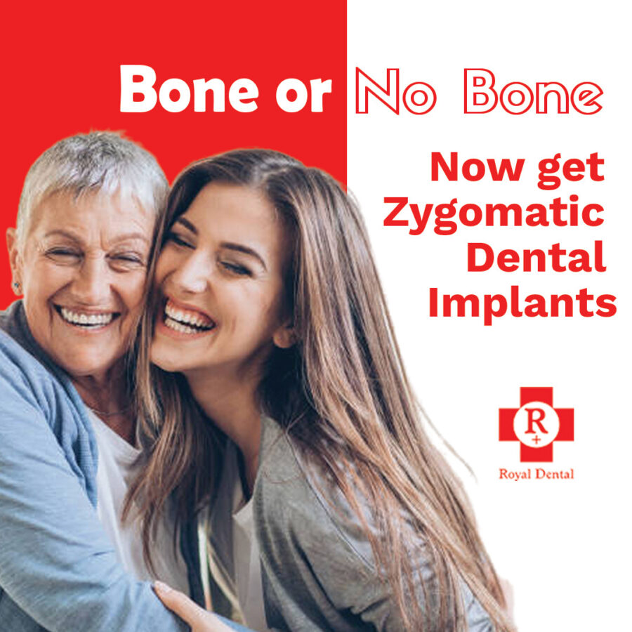 Zygomatic Dental Implants - Bone or No Bone at Royal Dental Clinics