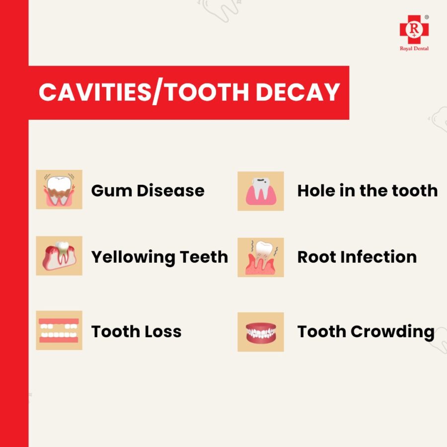 Do-cavities-repair-themselves?