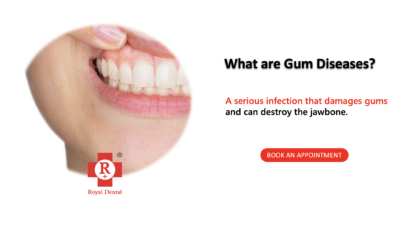 Gum diseases