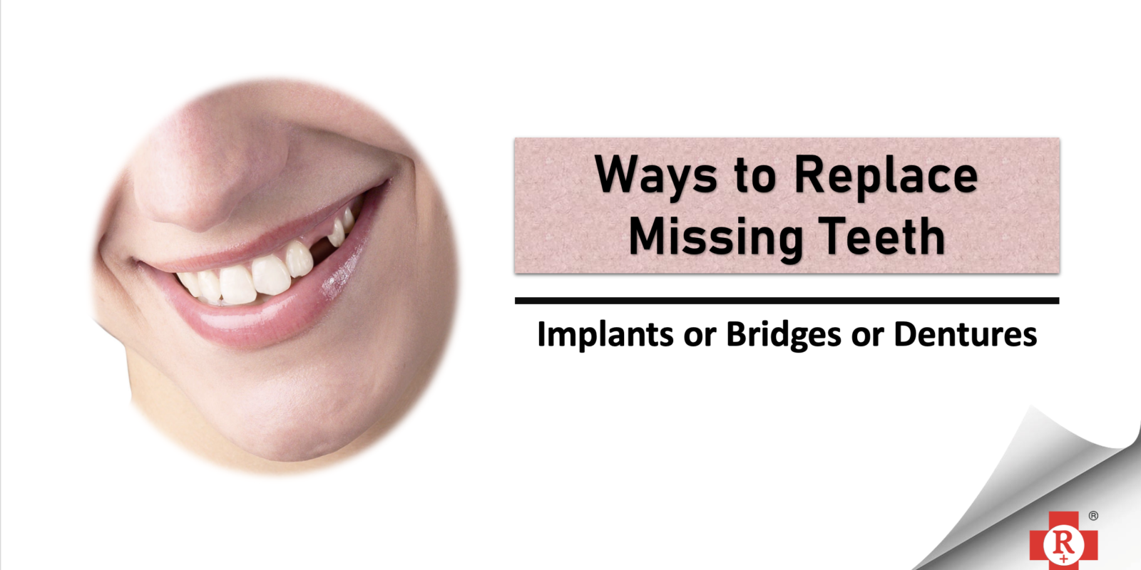 Missing Teeth replacement