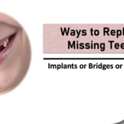 Missing Teeth replacement