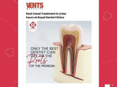 Root canal treatment Vents