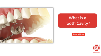 What is tooth cavity