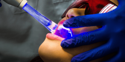 Dental laser technology