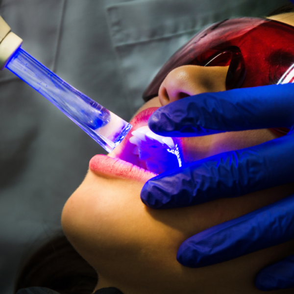 Dental laser technology
