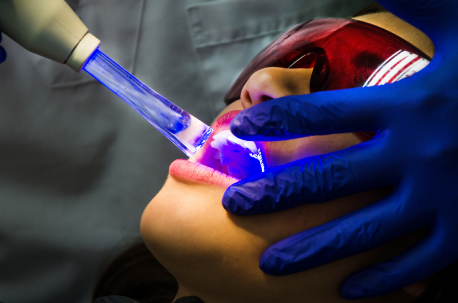 Dental laser technology, Laser teeth whitening costs in india