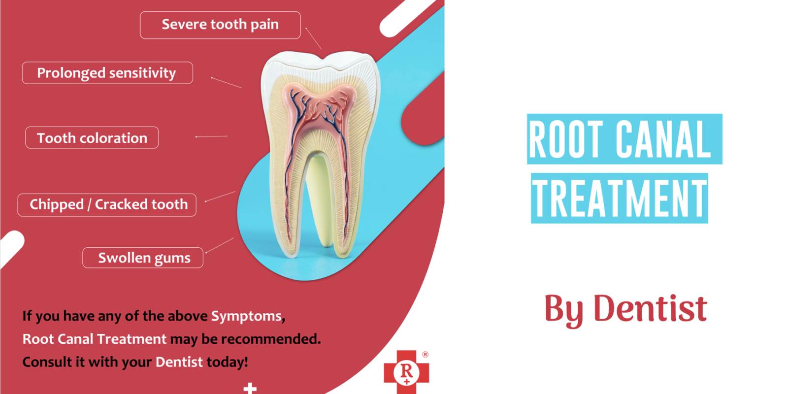 Root canal treatment by dentist in mumbai