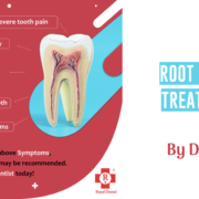 Root canal treatment by dentist in mumbai