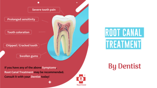 Root canal treatment by dentist in mumbai