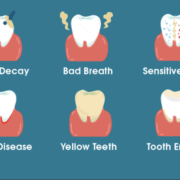 dental hygiene tooth loss