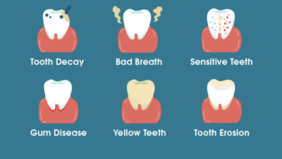 dental hygiene tooth loss