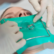 rubber dam root canal treatment